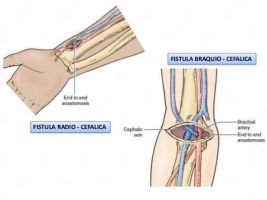 medicos angiologia cirugia vascular guadalajara Dr. Cesar Augusto Torres Velarde, Angiólogo